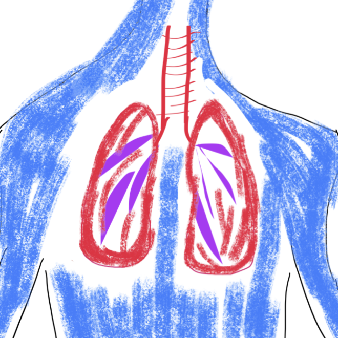 Ce trebuie sa fac daca tusesc si ma doare in spate?