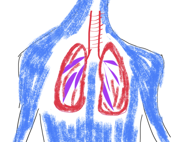 Ce trebuie sa fac daca tusesc si ma doare in spate?