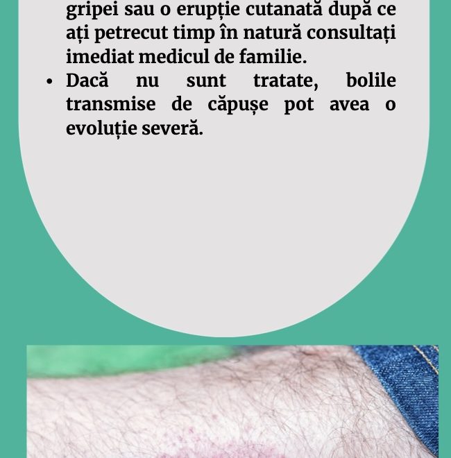 Care sunt semnele bolii transmise de căpușă?