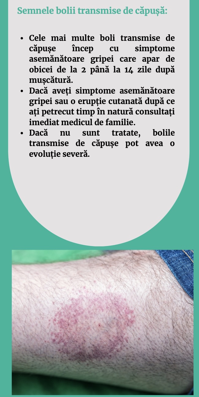 Care sunt semnele bolii transmise de căpușă?