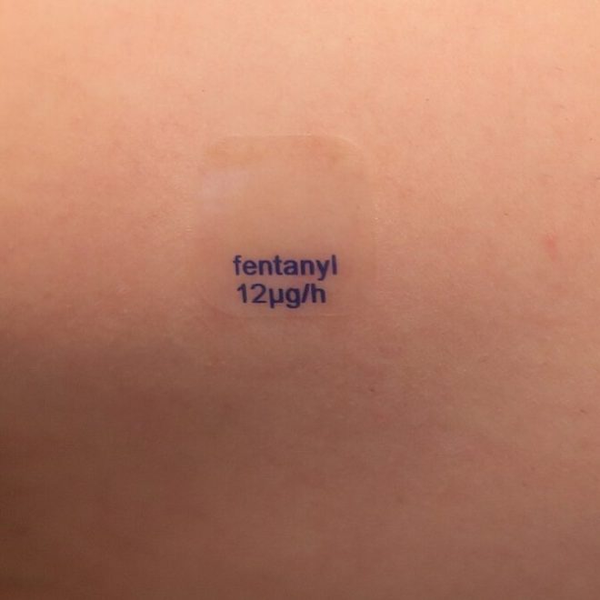 Ce efecte adverse au plasturii cu morfină Fentanil?