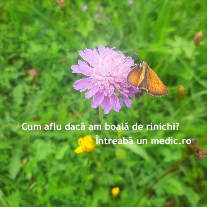 Cum aflu daca am boală de rinichi?