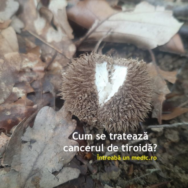 Cum se tratează cancerul de tiroidă?