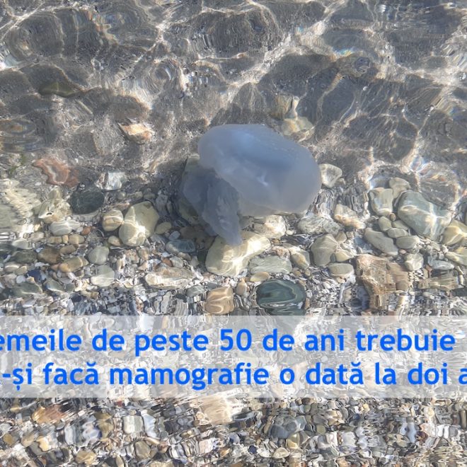 Femeile de peste 50 de ani trebuie să-și facă mamografie o dată la doi ani