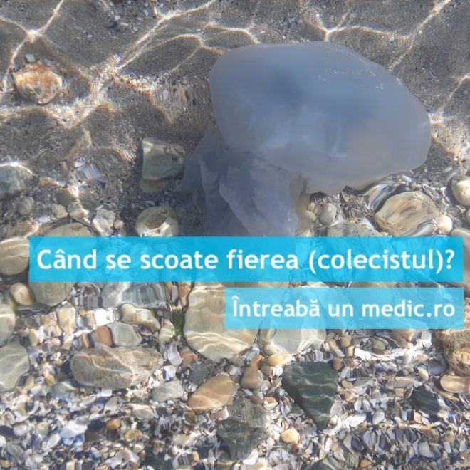 Când se scoate fierea (colecistul)?