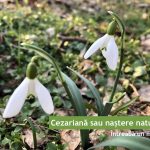 Cezariană sau naștere naturală?
